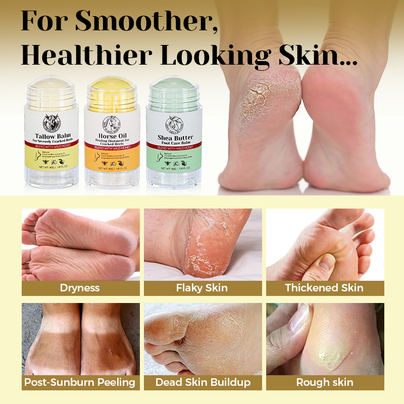 Beeswax Dead Skin Foot Callus Remover Foot Cream Care Stick Cracked Heel Repair Whipped Beef Tallow for Dry Feet - 12